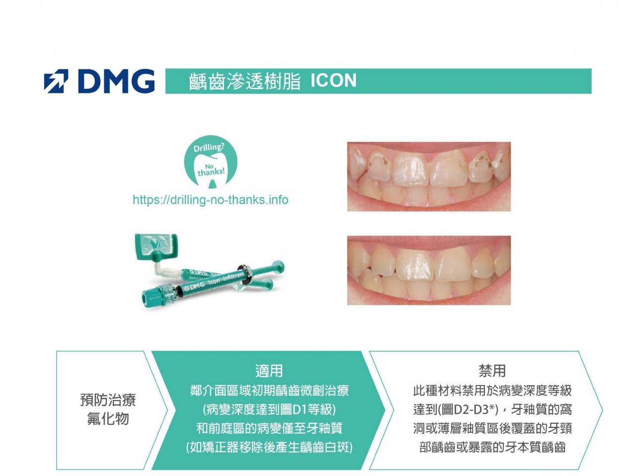 DMG 浸潤樹脂 ICON 功能特色一